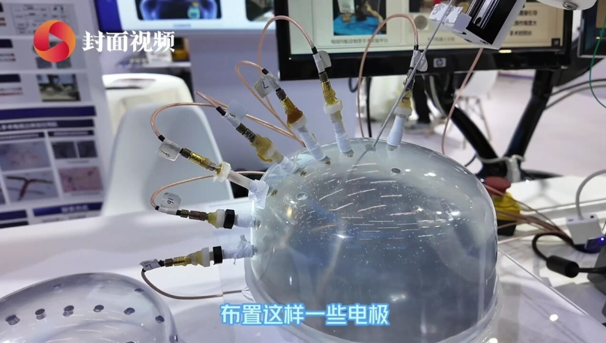 郑钦文比赛画面看不清球,澳门今晚开奖结果记录历史,展开解析落实_铂金版V9.31